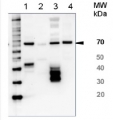 HSP70/HSC70 | Heat shock protein 70/Heat shock cognate protein 70 (serum)